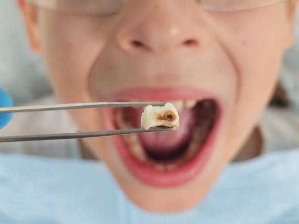 Dentist for Dental Trauma in OR